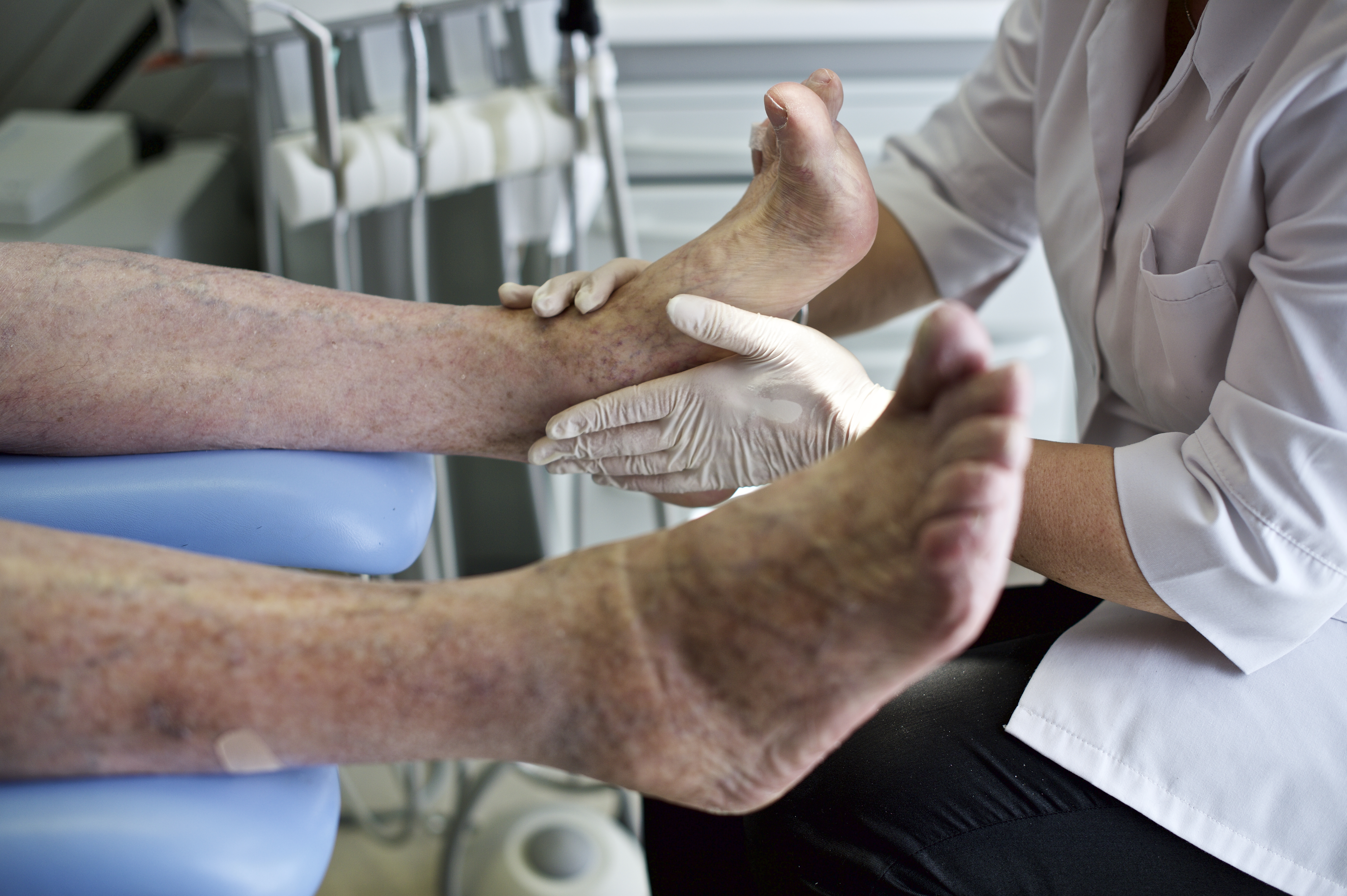 Lésions du pied diabétique : nouvelles stratégies de coordination interprofessionnelle